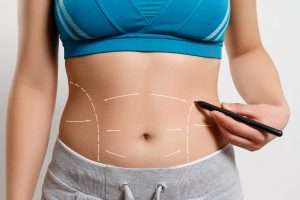 What Can Liposuction Treatment Do for Me?